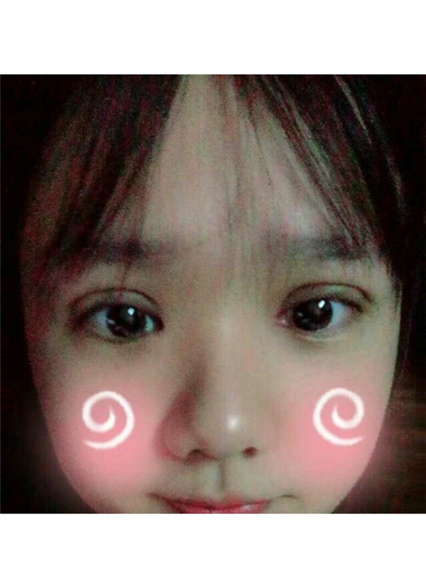 想做双眼皮的美女们进来看看我的案例吧!这里可以给你们很多参考哦~~我感觉我明明只是做了个双眼皮,却想变了个人一样!!