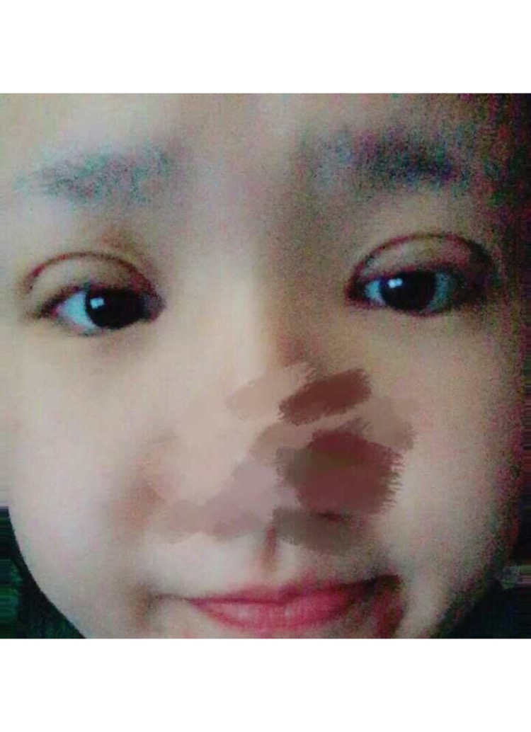 想做双眼皮的美女们进来看看我的案例吧!这里可以给你们很多参考哦~~我感觉我明明只是做了个双眼皮,却想变了个人一样!!