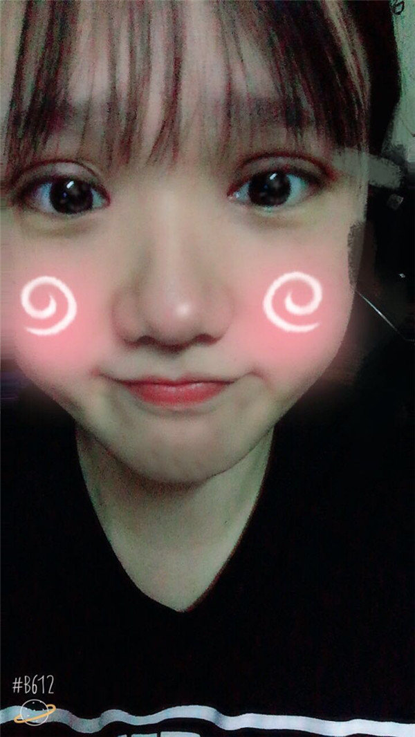 想做双眼皮的美女们进来看看我的案例吧!这里可以给你们很多参考哦~~我感觉我明明只是做了个双眼皮,却想变了个人一样!!