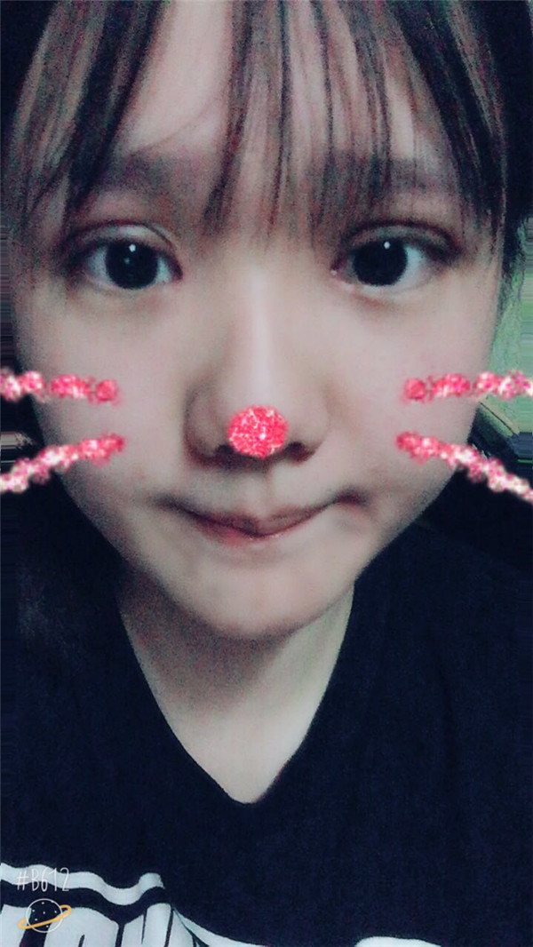 想做双眼皮的美女们进来看看我的案例吧!这里可以给你们很多参考哦~~我感觉我明明只是做了个双眼皮,却想变了个人一样!!