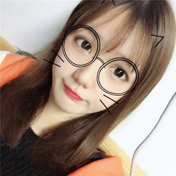 想做双眼皮的美女们进来看看我的案例吧!这里可以给你们很多参考哦~~我感觉我明明只是做了个双眼皮,却想变了个人一样!!