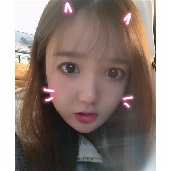 想做双眼皮的美女们进来看看我的案例吧!这里可以给你们很多参考哦~~我感觉我明明只是做了个双眼皮,却想变了个人一样!!