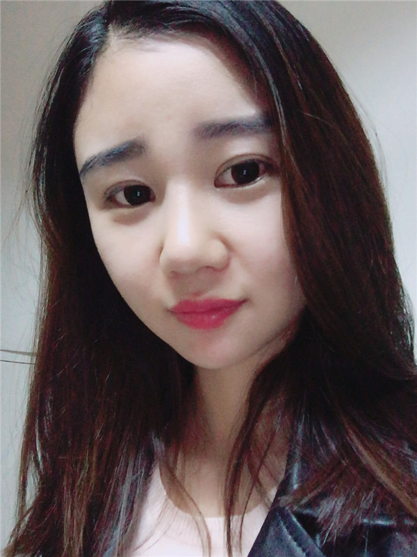 美女们,来看看我隆鼻的术前术后对比情况吧,是不是感觉变化好大!!可以为你们做做参考哦~~~