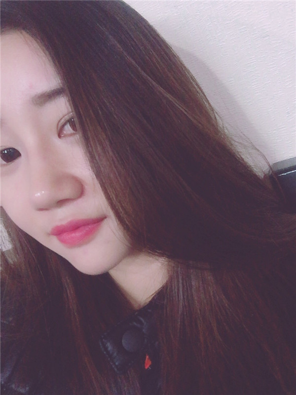 美女们,来看看我隆鼻的术前术后对比情况吧,是不是感觉变化好大!!可以为你们做做参考哦~~~
