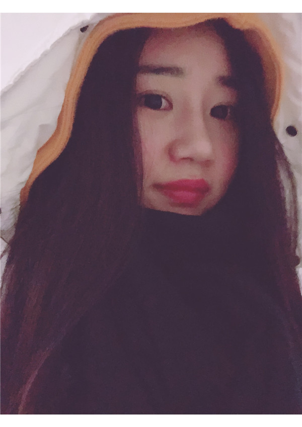 美女们,来看看我隆鼻的术前术后对比情况吧,是不是感觉变化好大!!可以为你们做做参考哦~~~