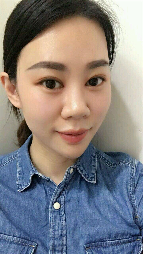 天气这么冷,我都不想敷面膜了~~~我来给姐妹们分享我的双眼皮变美经历啦!!!都进来看看我的案例吧~~有很多图片哦
