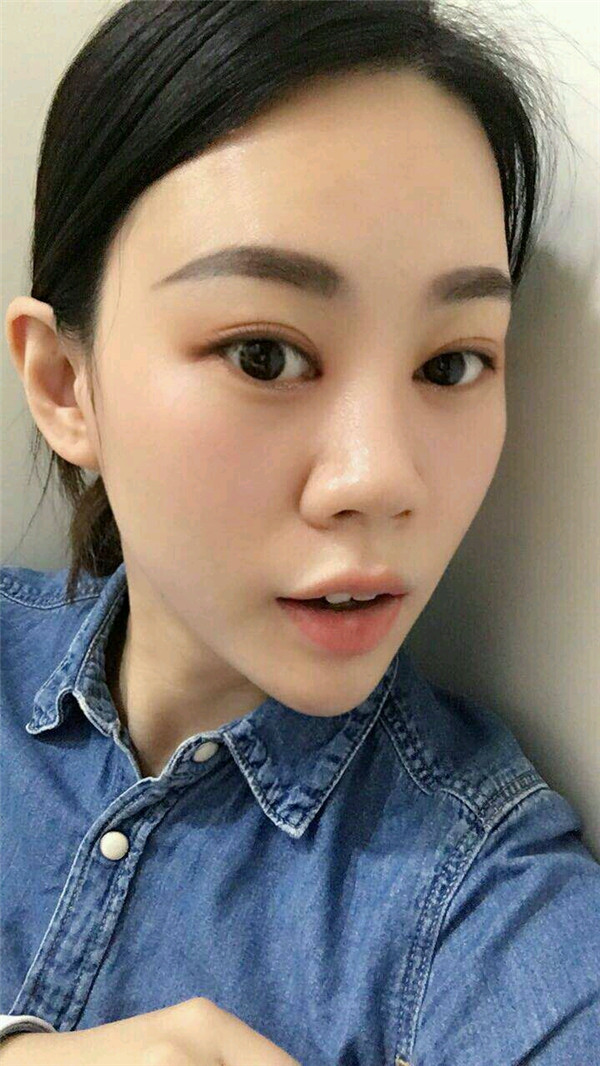 天气这么冷,我都不想敷面膜了~~~我来给姐妹们分享我的双眼皮变美经历啦!!!都进来看看我的案例吧~~有很多图片哦