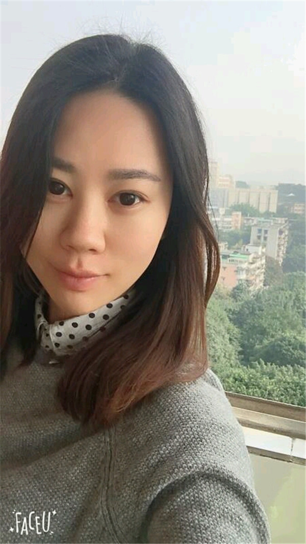 天气这么冷,我都不想敷面膜了~~~我来给姐妹们分享我的双眼皮变美经历啦!!!都进来看看我的案例吧~~有很多图片哦