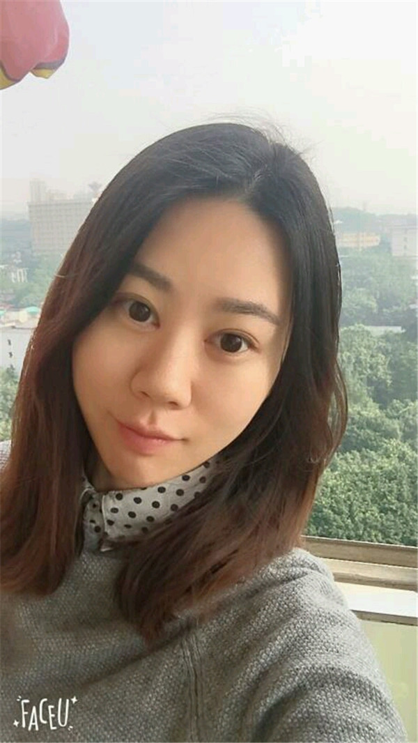 天气这么冷,我都不想敷面膜了~~~我来给姐妹们分享我的双眼皮变美经历啦!!!都进来看看我的案例吧~~有很多图片哦