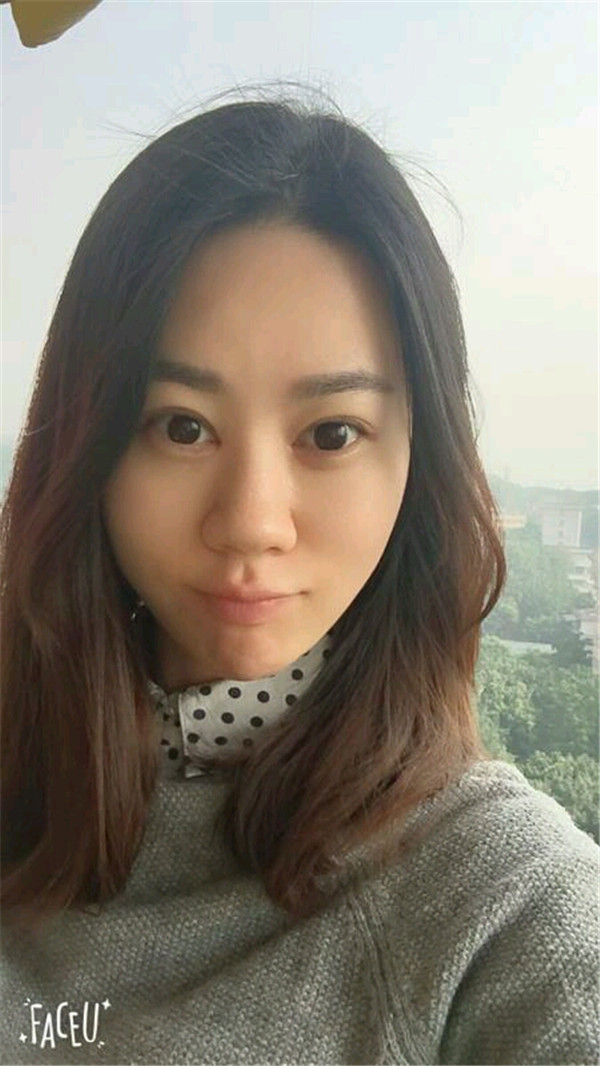 天气这么冷,我都不想敷面膜了~~~我来给姐妹们分享我的双眼皮变美经历啦!!!都进来看看我的案例吧~~有很多图片哦