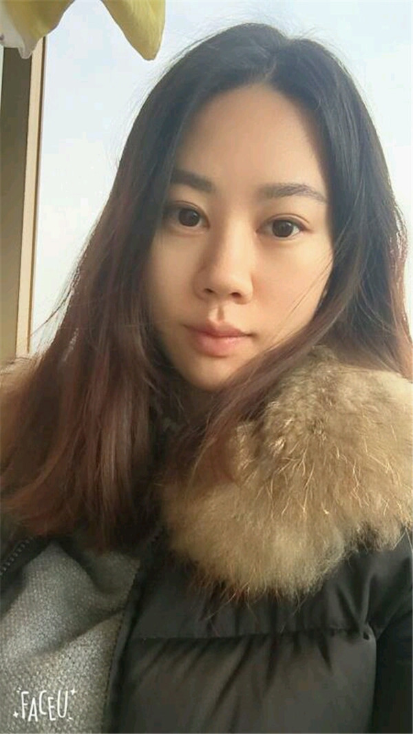 天气这么冷,我都不想敷面膜了~~~我来给姐妹们分享我的双眼皮变美经历啦!!!都进来看看我的案例吧~~有很多图片哦