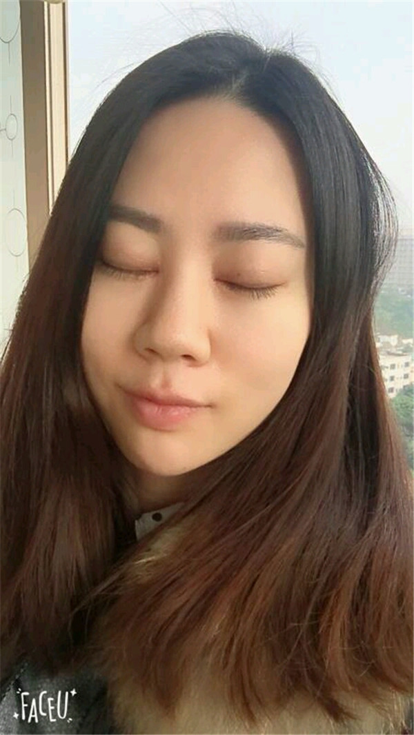 天气这么冷,我都不想敷面膜了~~~我来给姐妹们分享我的双眼皮变美经历啦!!!都进来看看我的案例吧~~有很多图片哦