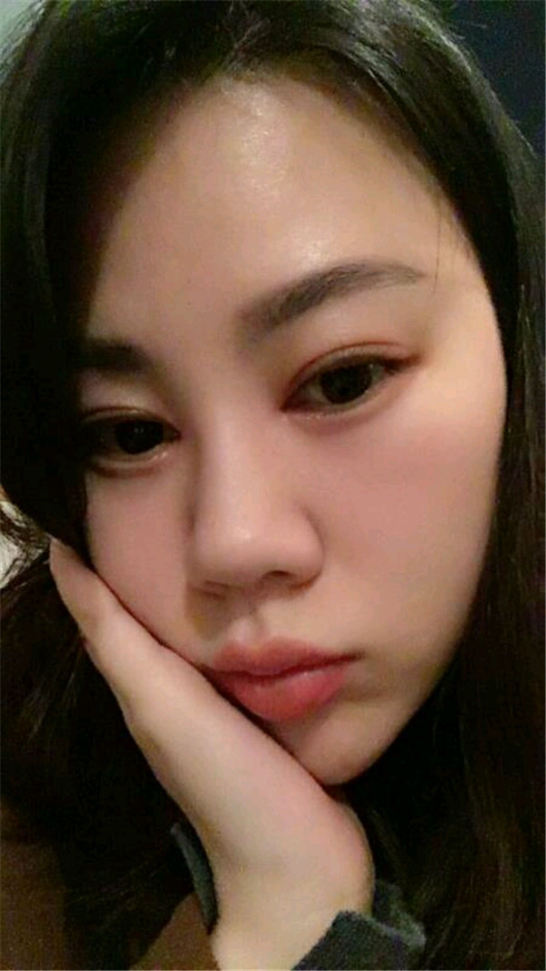 天气这么冷,我都不想敷面膜了~~~我来给姐妹们分享我的双眼皮变美经历啦!!!都进来看看我的案例吧~~有很多图片哦