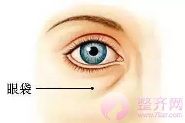 【hey朋友,你的眼袋就快能装下只袋鼠了】