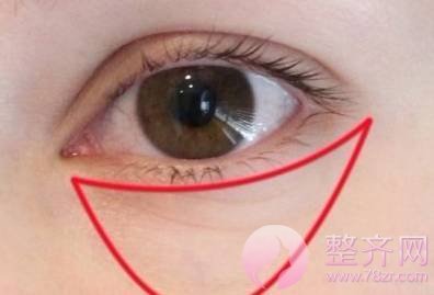 【hey朋友,你的眼袋就快能装下只袋鼠了】