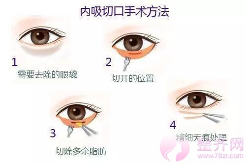 【hey朋友,你的眼袋就快能装下只袋鼠了】