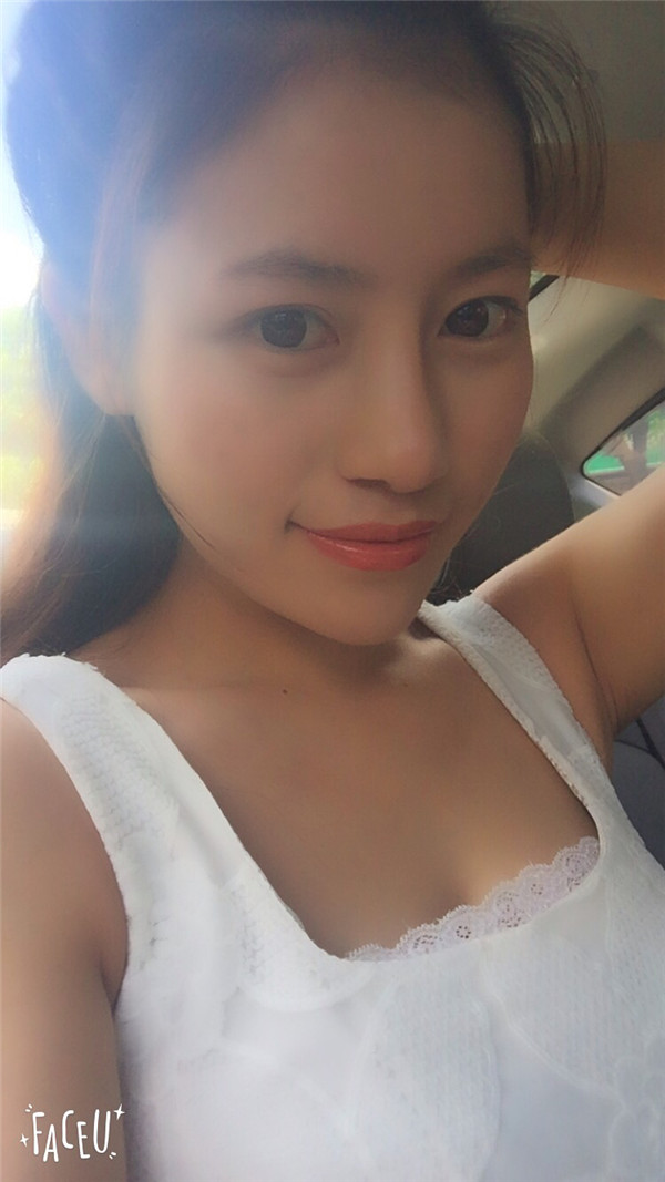 现在大众对整形的接受度越来越高了,我做了鼻部手术,我做的是偏自然的鼻子,来看看我的案例吧!!
