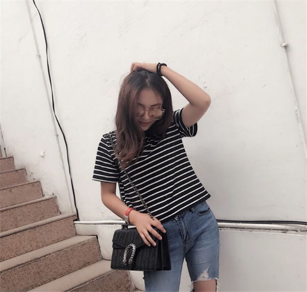 我的面部吸脂案例,从大脸妹子变成小脸女神只用了一个月!宝宝们进来看看我的神奇变化吧~~~~~