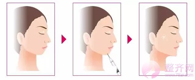 大脸的烦恼,小V脸永远不懂!