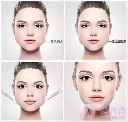 大脸的烦恼,小V脸永远不懂!