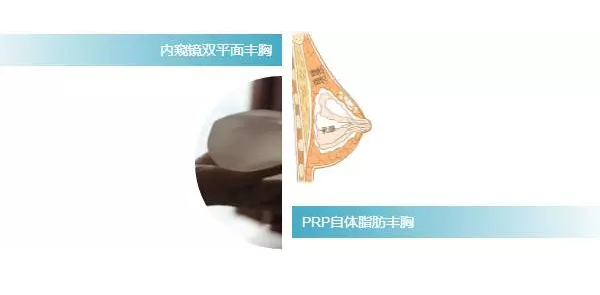 自体脂肪隆胸 VS 假体隆胸,你适合哪种?!