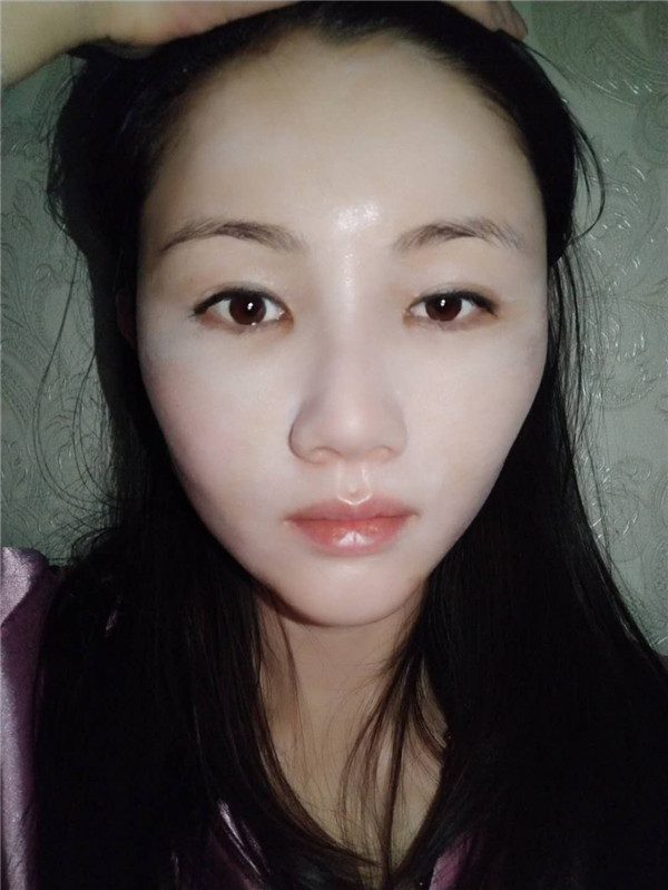 哈喽朋友们你们好,我刚做了自体脂肪填充脸部的手术,分享下我的历程,希望能帮助到有要了解这个项目的你们 ~~~