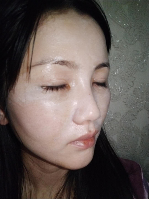 哈喽朋友们你们好,我刚做了自体脂肪填充脸部的手术,分享下我的历程,希望能帮助到有要了解这个项目的你们 ~~~