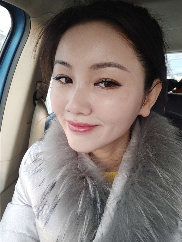 哈喽朋友们你们好,我刚做了自体脂肪填充脸部的手术,分享下我的历程,希望能帮助到有要了解这个项目的你们 ~~~