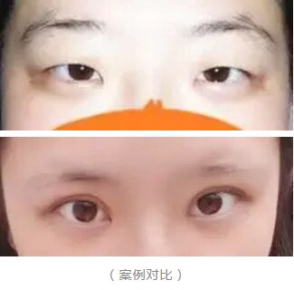 眼睛好看是种怎样的体验?