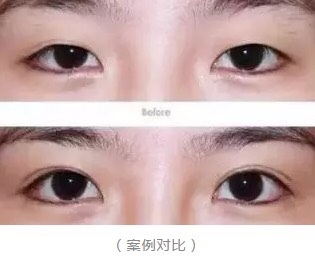 眼睛好看是种怎样的体验?