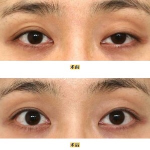 眼睛好看是种怎样的体验?