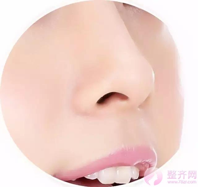这些都不知道,你还隆什么鼻?