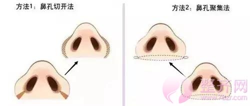 这些都不知道,你还隆什么鼻?