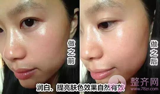 注射瘦脸不只瘦脸这一个功