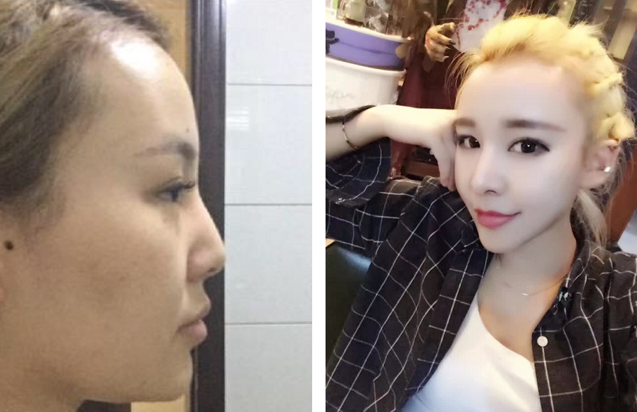 什么样的长相算是偏男相呢?主要看鼻子!