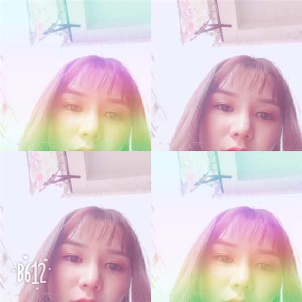 分享我的注射瘦脸瘦脸经历啦,新的一天新的开始!美女们进来分享一下保养秘诀呀!!!