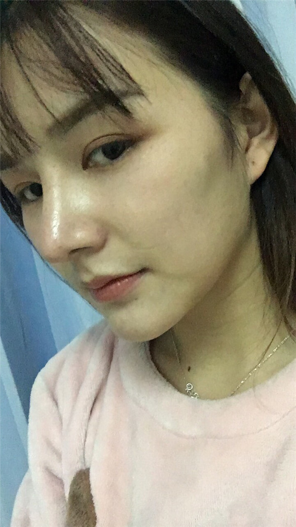 分享我的注射瘦脸瘦脸经历啦,新的一天新的开始!美女们进来分享一下保养秘诀呀!!!