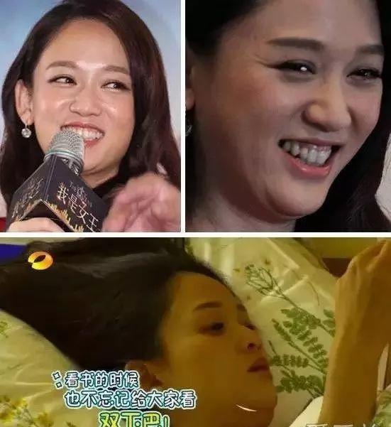 埋线提升,女人颜值的生命线!