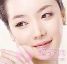 美颜当道,不整容感觉好吃亏?