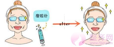 美颜当道,不整容感觉好吃亏?
