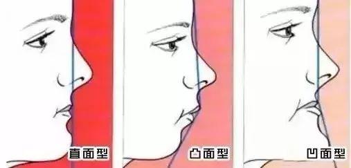 侧脸美的标准是什么?