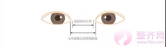 如何有一对令人羡慕的双眼皮!