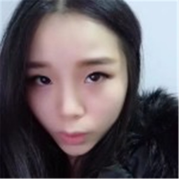 【双眼皮手术】终于去做了心心念念的双眼皮手术啦~~来看看我的案例吧!我没开眼角哦,宝宝们你们开眼角了没?