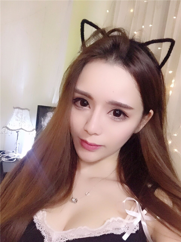 【双眼皮手术】终于去做了心心念念的双眼皮手术啦~~来看看我的案例吧!我没开眼角哦,宝宝们你们开眼角了没?