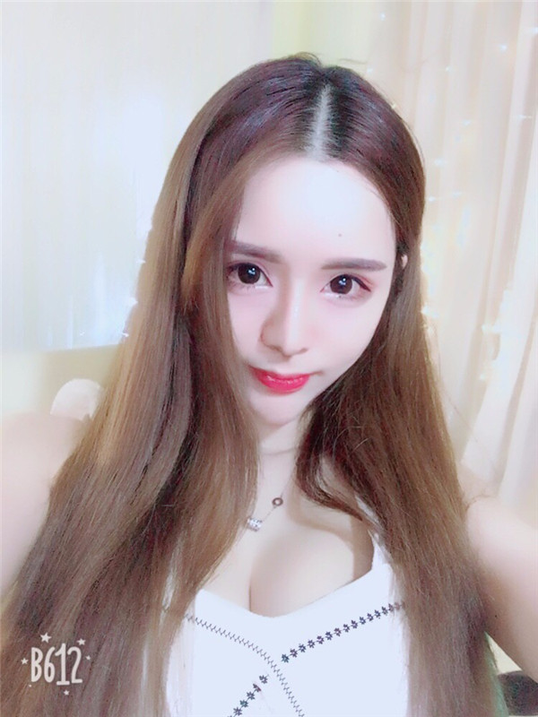 【双眼皮手术】终于去做了心心念念的双眼皮手术啦~~来看看我的案例吧!我没开眼角哦,宝宝们你们开眼角了没?