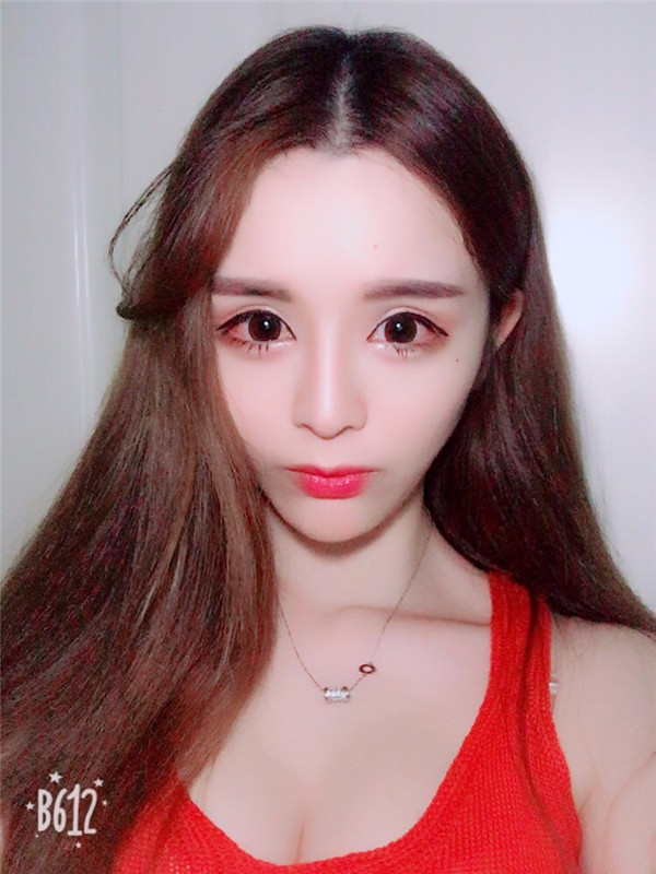 【双眼皮手术】终于去做了心心念念的双眼皮手术啦~~来看看我的案例吧!我没开眼角哦,宝宝们你们开眼角了没?