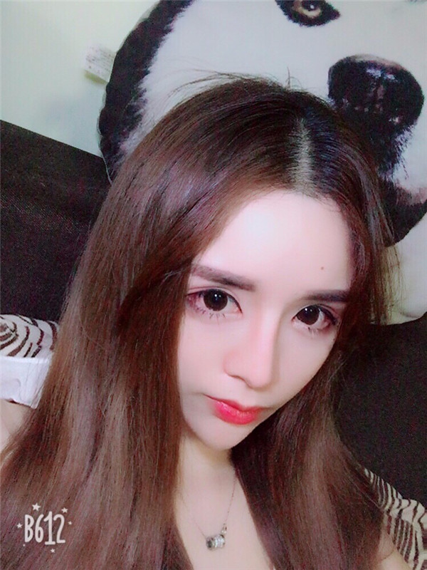 【双眼皮手术】终于去做了心心念念的双眼皮手术啦~~来看看我的案例吧!我没开眼角哦,宝宝们你们开眼角了没?