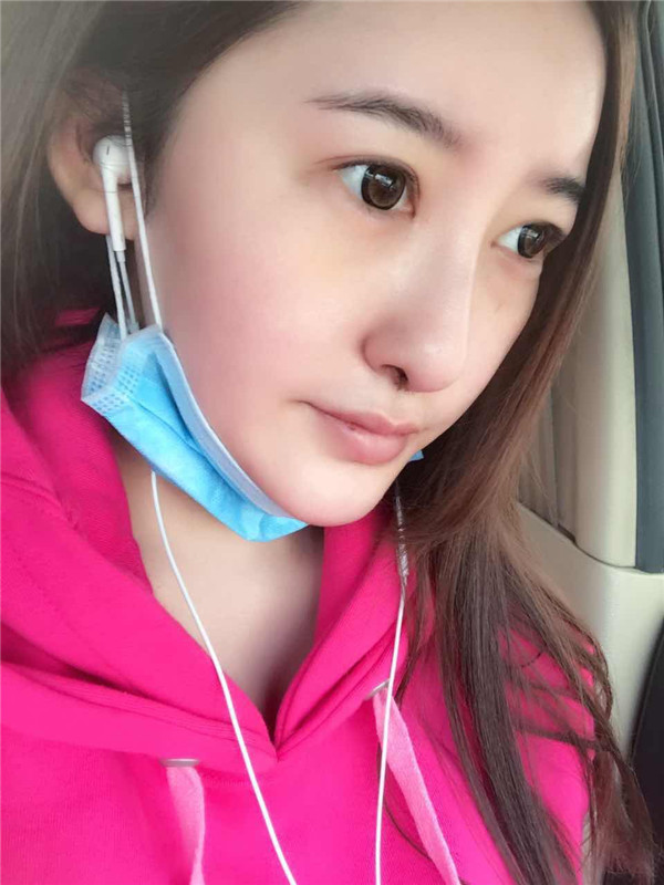 【硅胶隆鼻+耳软骨垫鼻尖】想让自己更完美就去做了隆鼻手术,果还较为的不错,和大家分享一下我的案例!