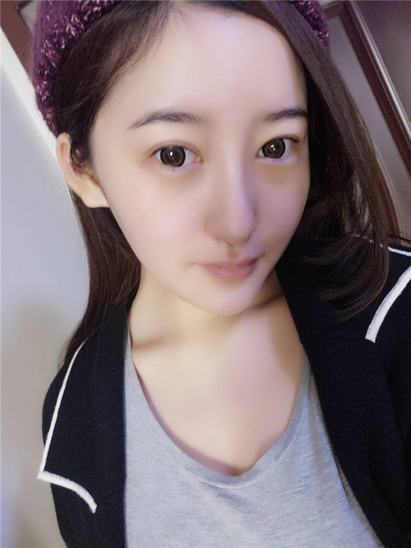 【硅胶隆鼻+耳软骨垫鼻尖】想让自己更完美就去做了隆鼻手术,果还较为的不错,和大家分享一下我的案例!