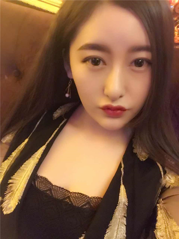 【硅胶隆鼻+耳软骨垫鼻尖】想让自己更完美就去做了隆鼻手术,果还较为的不错,和大家分享一下我的案例!